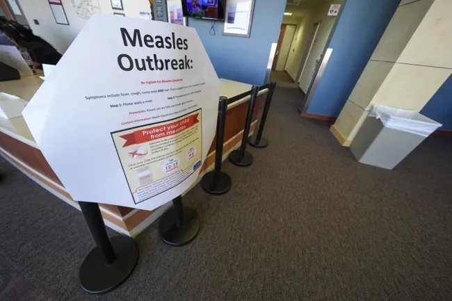 Measles in West Texas